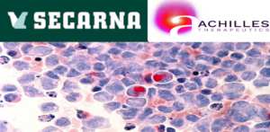Secarna, Achilles, Therapeutics, Sign, Multiple, Agreement, Develop, Optimized, Tcell, Therapies, Fast, Reliable, Scalable, Efficient, Drug, Discovery, Platform, Nextgeneration,  Antisense, Oligonucleotide,
